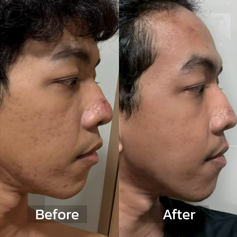 Before After Review 1