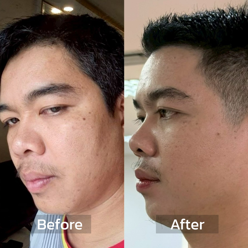 Before After Review 3