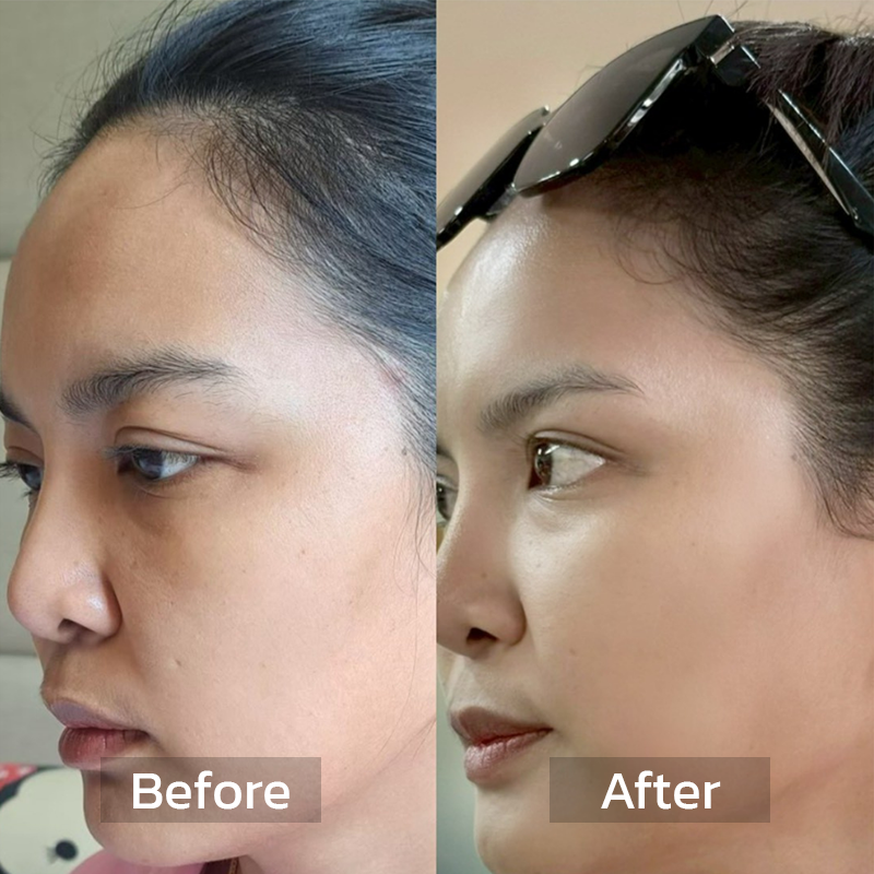 Before After Review 2